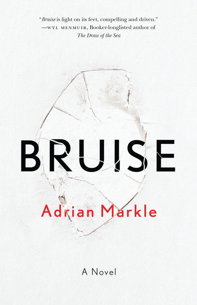 markle bruise