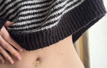 Photo of a hand touching bruised tummy button with striped jumper rising up